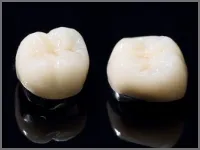 ジルコニアセラミックスクラウン