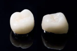 ⑥メタルボンドクラウン（かぶせ物）