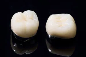 ⑦ハイブリッドセラミッククラウン（かぶせ物）