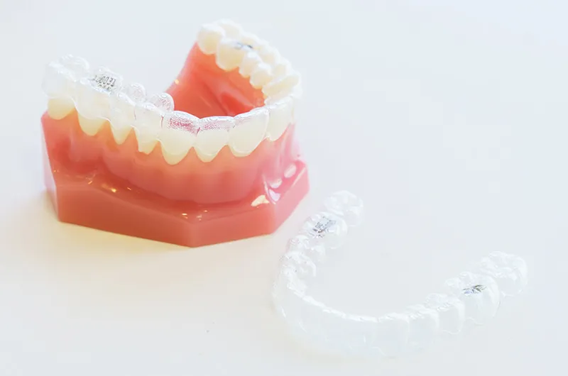 ③マウスピース型矯正